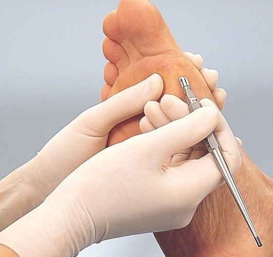 RUCK®  Podologiczne dłuto 8 mm, 20 szt.