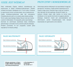 RUCK® smartgel, orteza na palec młotkowy z potrójnym pierścieniem, prawa, L/XL, 10 szt.