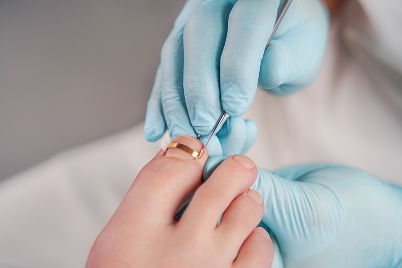 Klamry ortonyksyjne GOLDSTADT professional - klejone i połówki