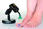 Fotodynamiczna terapia PACT® MED przeciw grzybicy paznokci