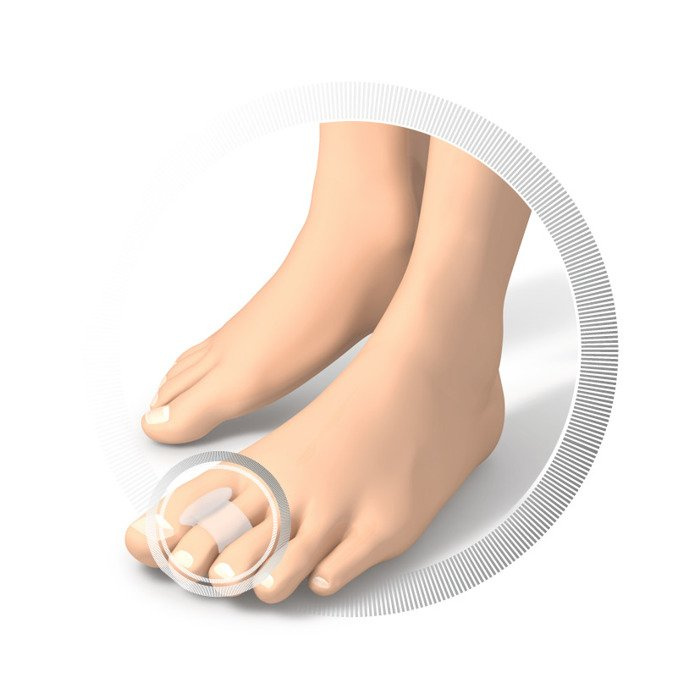 RUCK® smartgel, specjalistyczny separator pierścieniowy do stóp, b.mały, 4 szt.