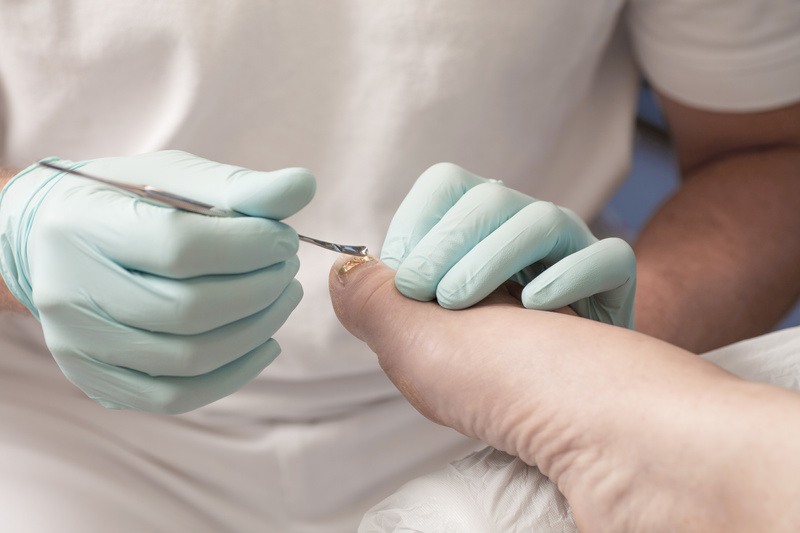 Klamry ortonyksyjne GOLDSTADT professional - klejone i połówki